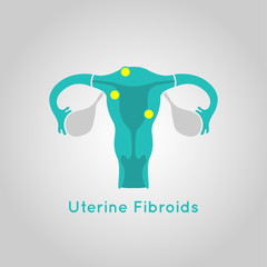 Uterine Fibroids logo vector icon design illustration