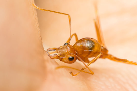 Macro Of Ant (Red Ant) Biting On Human Skin