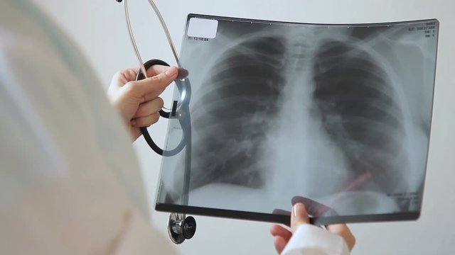 Skilled doctor holds X-ray of lungs, standing in clinic indoors. Young woman holds phonendoscope and summary image of soft tissues of human chest, imprinted on paper and carefully examines it