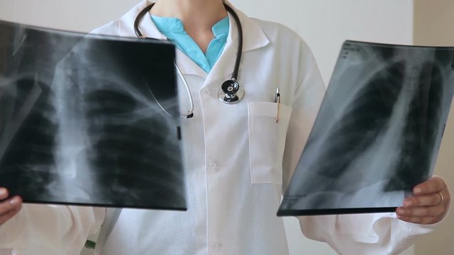 Doctor with a stethoscope examines two X-rays of human chest. Medical officer in uniform in hospital compares several results of a fluorographic survey.