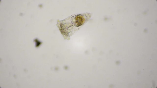 Vorticella ciliates under the microscope in 4k