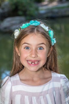 Funny portrait of little girl who lost front teeth. City park in the summer time
