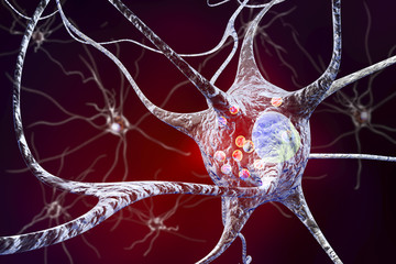 Parkinson's disease. 3D illustration showing neurons containing Lewy bodies small red spheres which are deposits of proteins accumulated in brain cells that cause their progressive degeneration - obrazy, fototapety, plakaty