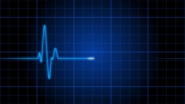 EKG 001: An electrocardiogram heart monitor pulses on a blue grid (Loop).