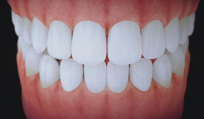 Medical denture,3D teeth close up.