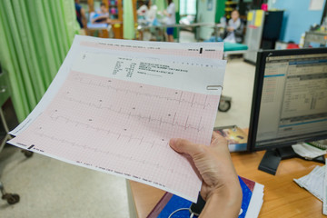 Heart analysis, electrocardiogram graph (ECG) in hand doctor at the hospital . - 179105112
