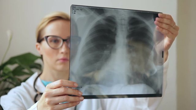 Female doctor with glasses holds up series of X-ray picture of breast. Strict woman physician to compare two pictures fluorography examination of patient.