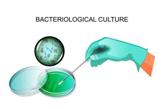 bacterial inoculation in the laboratory