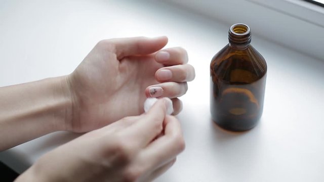 Horrible trauma of fingernail. Subungual hematoma. Bruise under the nail of the hand. Injury to the nail. Sick nail. Sickly, diseased, unhealthy nail