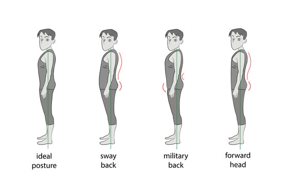 types of posture in men. vector illustration.