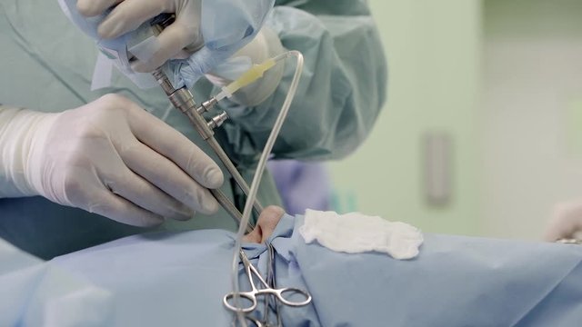 close-up. the hands of the neurosurgeon performs a craniotomy through the nose endoscopic approach