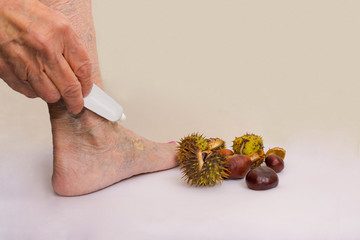 The female leg and hand with medicine cream from horse chestnuts