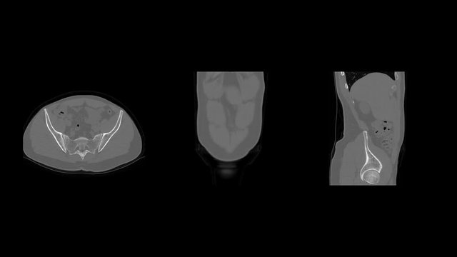 Raw CT scan DICOM images of human body, radiography x-ray examination, MRI tomography seamlessly looped animation, computed tomography scanning.