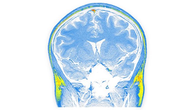 Computed medical tomography MRI upscaled scan of healthy young female brain. Front/rear view. Discrete slices. Red, yellow, blue on white background.