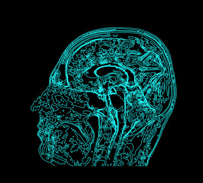 Topographic map MRI of the human brain.