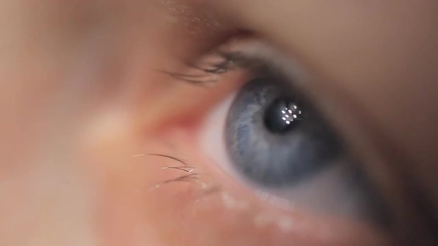 a young woman dripping medicinal drops in her eyes. close-up