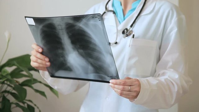 Young doctor looks at radiograph of chest in clinic indoors. She holds in hands two images of human lungs and carefully compares them, taking into account details. Experienced specialist dressed in