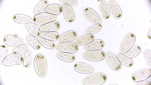 unicellular microorganism - paramecium under the microscope video clip