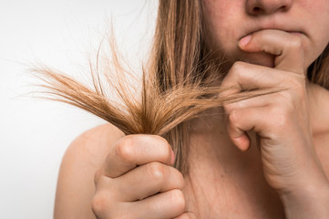 Hair problems - brittle, damaged, dry and loss hair concept