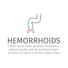 vector illustration of a prolapsed hemorrhoid veins