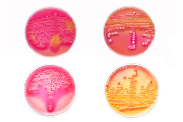 Mixed of bacteria colonies in petri dish (MacConkey agar)