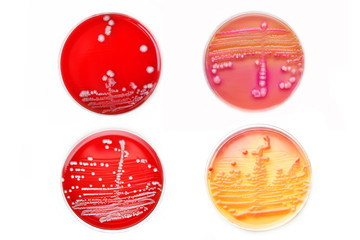 Mixed of bacteria colonies in various petri dish