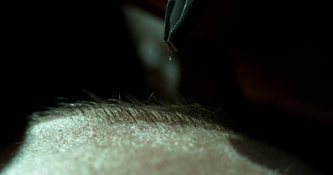 Plucking a Hair Closeup