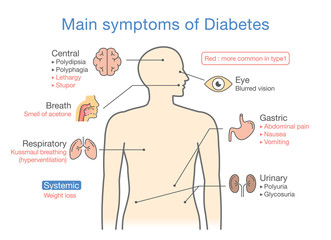 Main symptoms of Diabetes. Illustration about diagram for medical diagnosis of people disease.