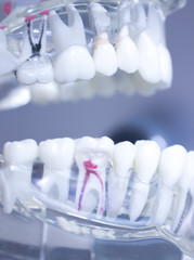 Dental teeth mouth model