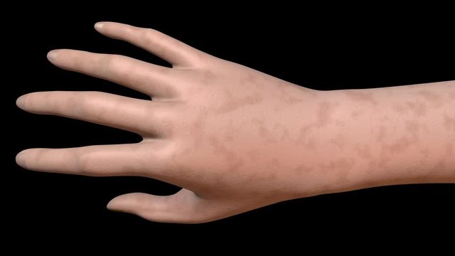 Age spots vanish from skin on hand,arm. Subtle rotation. 3d animation
