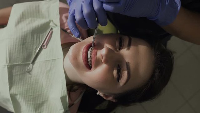 Orthodontist put on elastic on braces. Healthy teeth. Good smile of the patient