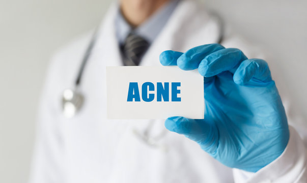 Doctor holding a card with text ACNE, medical concept