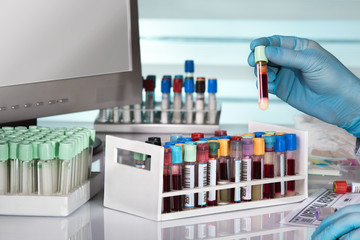 Doctor holding blood test tube in front of computer of the laboratory / hand of technician working...