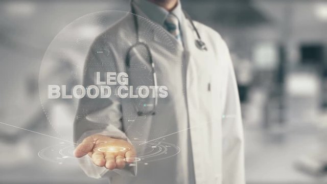 Doctor holding in hand Leg Blood Clots