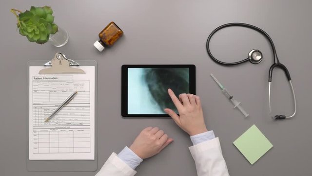 Overhead Top View View Of Doctor Examining Xray On Digital Tablet
