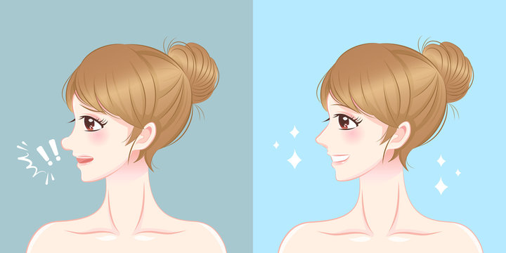 Cartoon Woman Nose Surgery