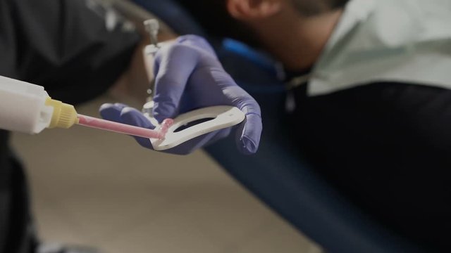 Registration of bite, dental imprint