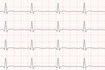 Cardiogram of heart beat. ECG on chart paper. Vector illustration.