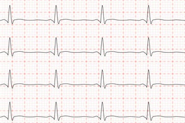 Cardiogram of heart beat. ECG on chart paper. Vector illustration.