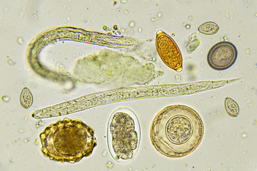 Mixed of helminthes in stool, analyze by microscope
