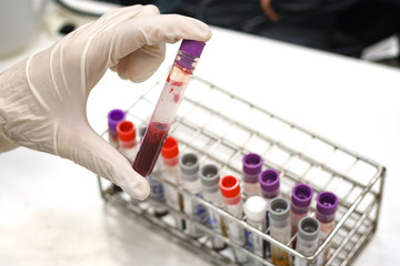 scientist check blood example in vacutainer