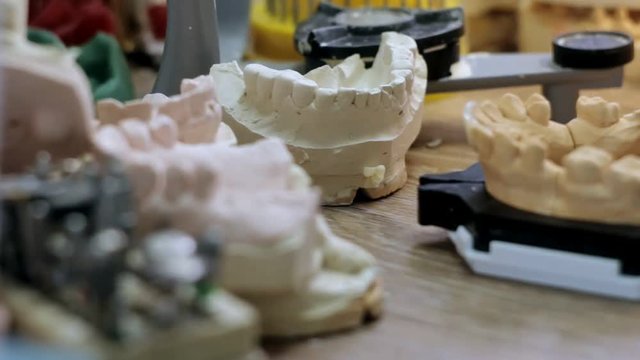 Desk prosthetist, a lot of models of dental jaw prostheses