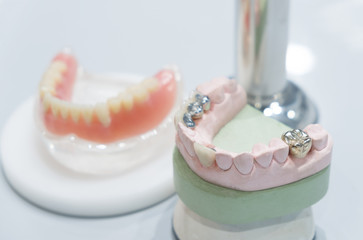 Crown and bridge equipment and model express fix restoration.