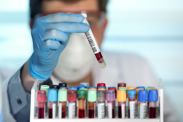 doctor holding blood sample tube /technician in laboratory with blood sample tube 