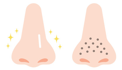 鼻の黒ずみ　ビフォアアフター