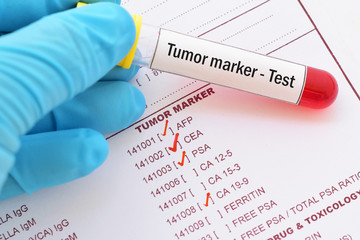 Blood sample with requisition form for tumor marker test in male
