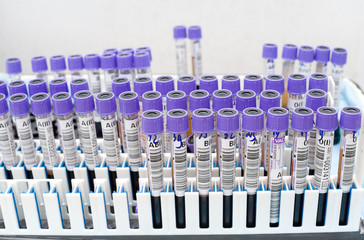 Fototapeta premium test tubes with donor blood