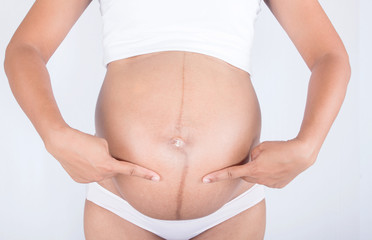 linea nigra and stretch marks on pregnant women