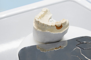 Crown and bridge equipment and model express fix restoration.