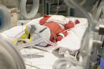 Premature baby being cared for in incubator